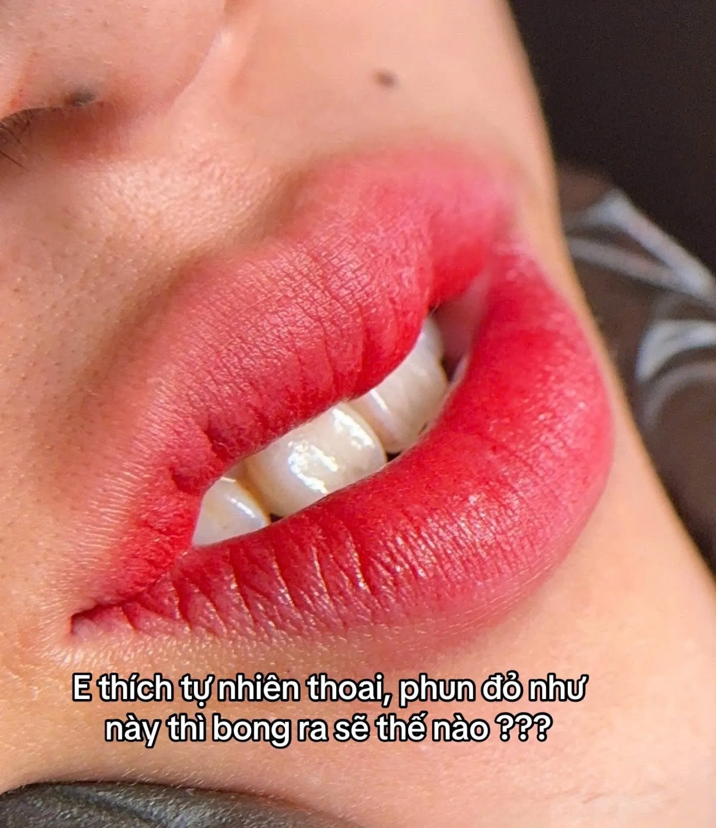 Khách hàng thực tế tại Sunrise Beauty